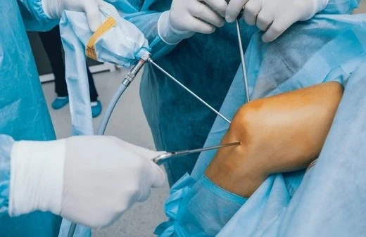 Arthroscopy Surgery -Ortho